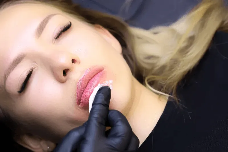 The image shows a person undergoing a cosmetic procedure on their lips